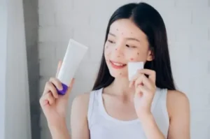 Best Skincare Products for Treating Acne that are Effective and Effective